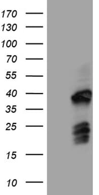 FAM131C Antibody (clone OTI6F2)