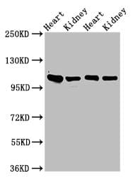 ITGA6/Integrin Alpha 6/CD49f Antibody