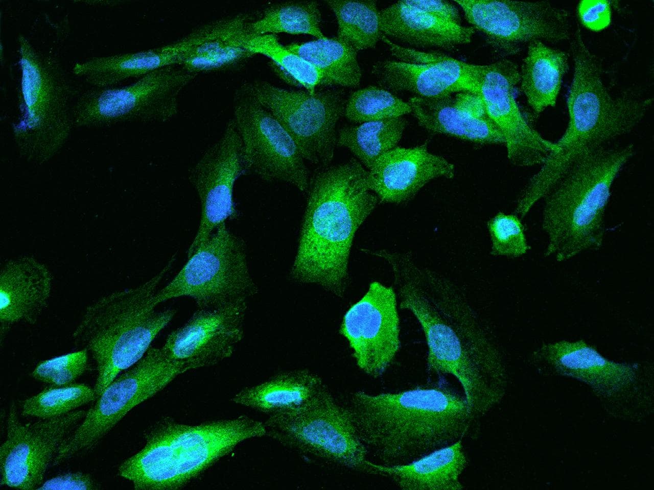 TEX264 Antibody
