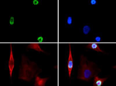 HIST3H3 Antibody (phospho-Ser28)