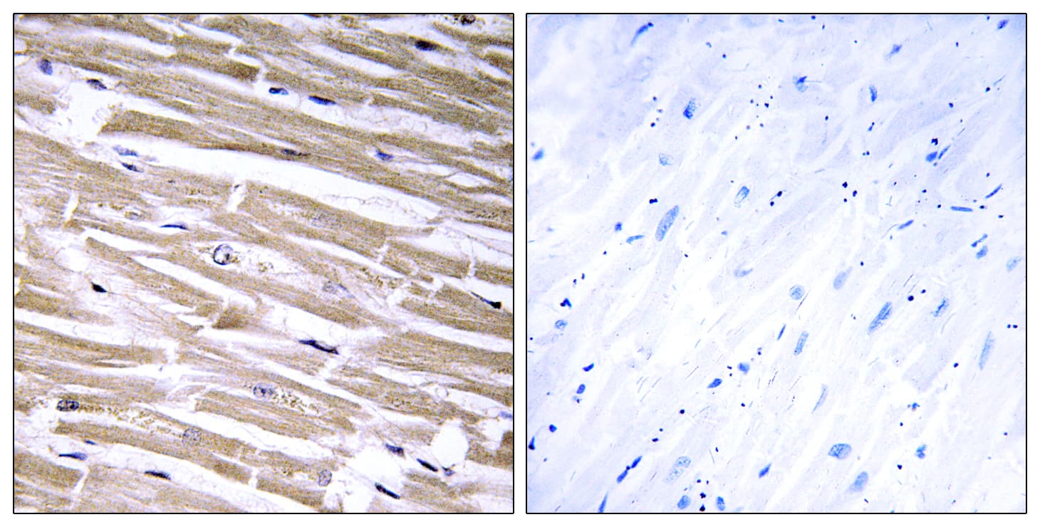 GLCT2 / B3GALT2 Antibody (aa373-422)