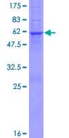 Human ECI1 / DCI Protein (Recombinant GST)