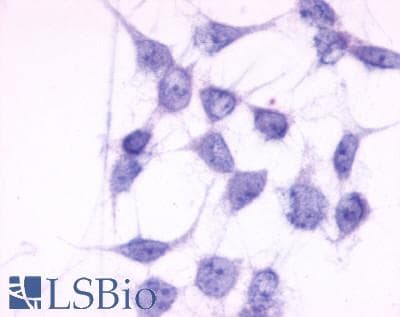 PathPlus™ P2RY6 / P2Y6 Antibody (C-Terminus)