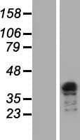 Human TCEA3 Protein (Over-Expression Lysate Myc-DDK (Flag))