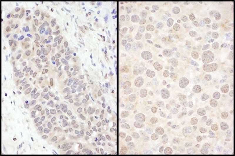 Polyclonal Rabbit anti-Human FOXO3 / FOXO3A Antibody (aa250-300, IHC, WB)