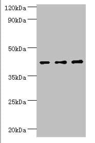 Polyclonal Rabbit anti-Human SERPINB1 Antibody (aa100-379, IHC, WB)