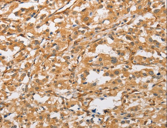 ARMCX1 Antibody
