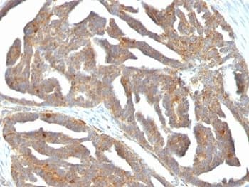 GnRH receptor / GNRHR Antibody (aa1-29, clone F1G4 or GNRH03, Ready-to-Use)