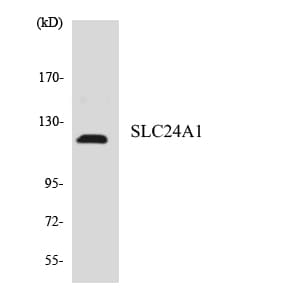 Polyclonal Rabbit anti-Human SLC24A1 / NCKX Antibody (aa139-188, WB)