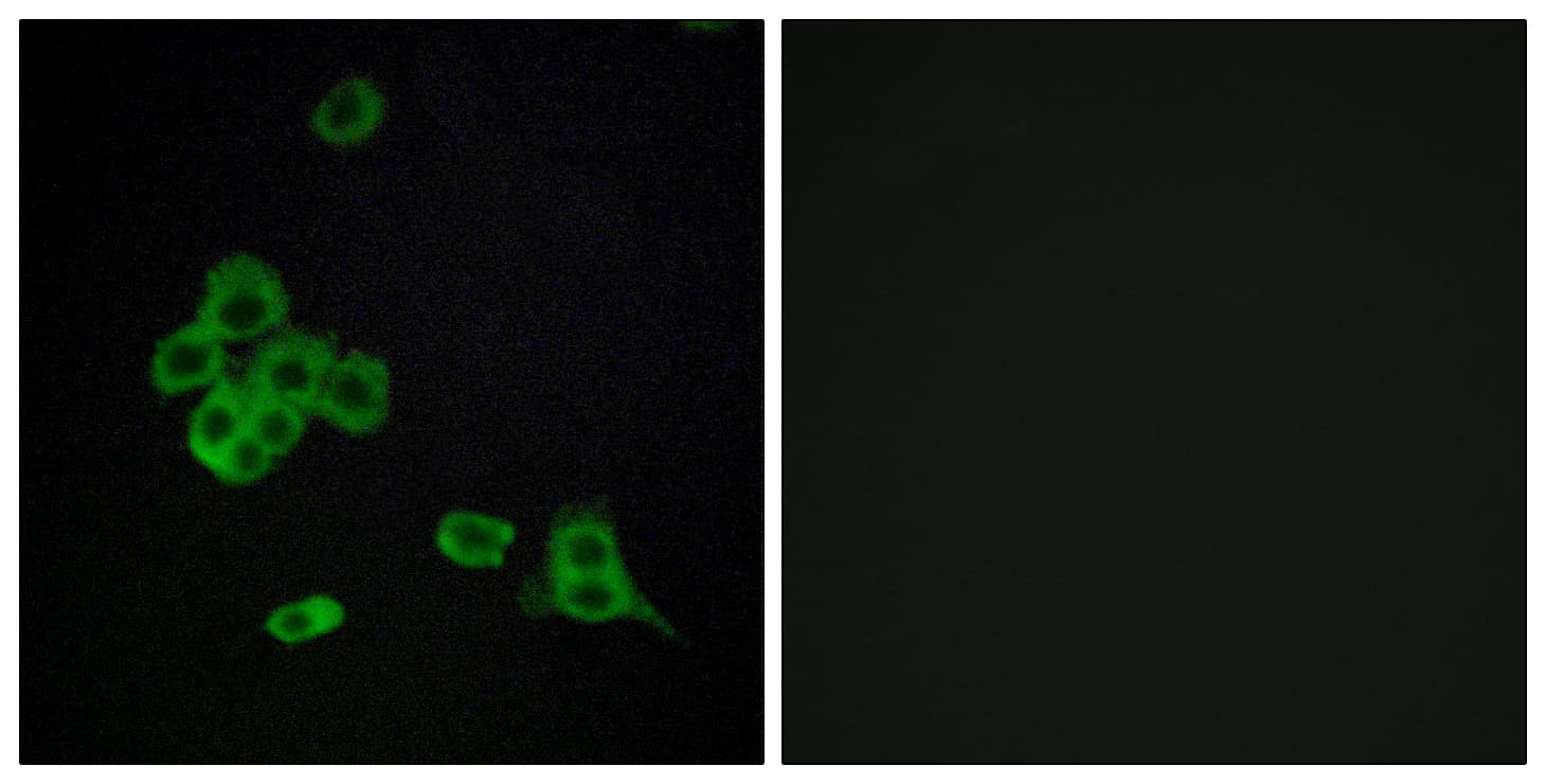 Polyclonal Rabbit anti-Human CDH26 / Cadherin 26 Antibody (aa11-60, IF)