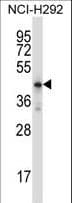 IHC-plus™ HOXD10 Antibody (aa201-230)