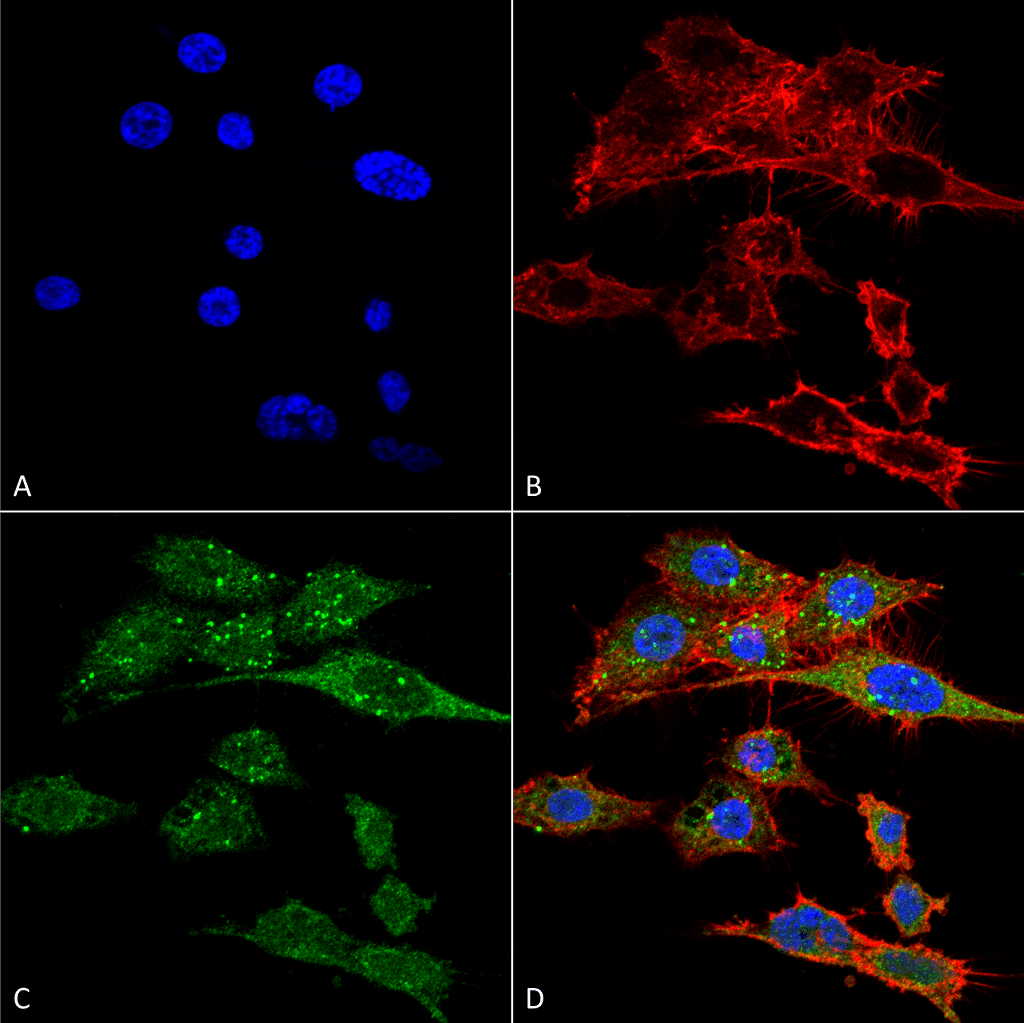 KIAA0226 / RUBICON Antibody