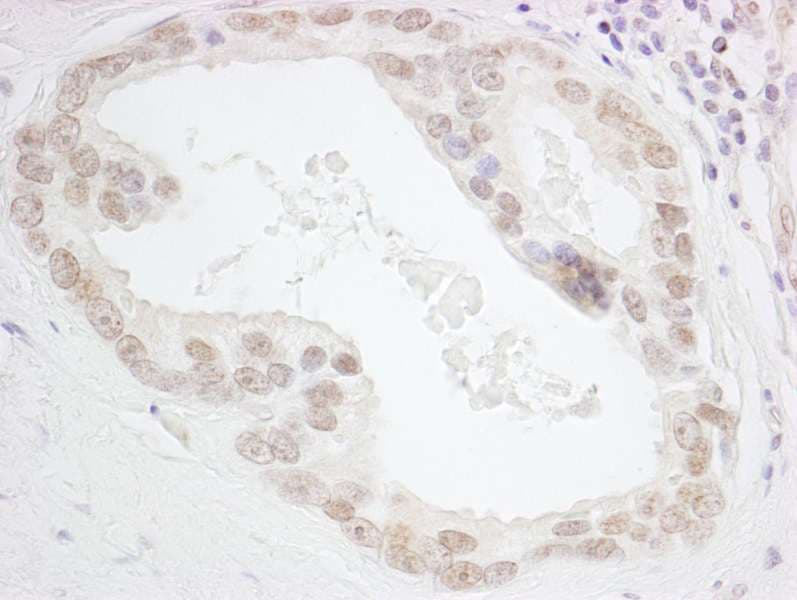HMGN3 Antibody (aa60-99)