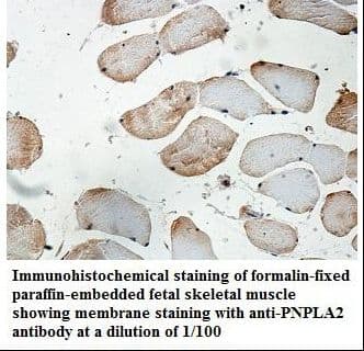 Polyclonal Rabbit anti-Human PNPLA2 / ATGL Antibody (aa122-340, IHC, WB)