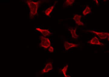 PR / Progesterone Receptor Antibody