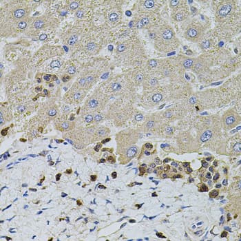 IHC-plus™ Polyclonal Rabbit anti-Human S100A12 Antibody (IHC, WB)