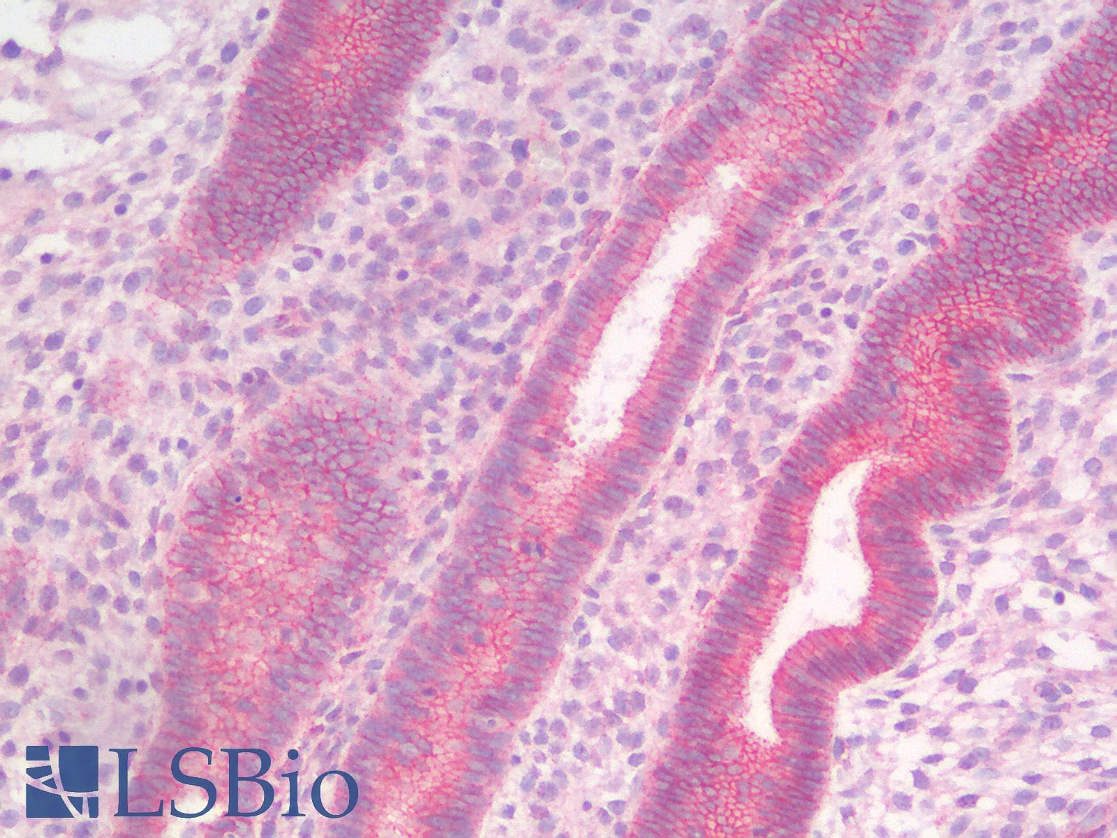 PathPlus™ CTNNB1 / Beta Catenin Antibody