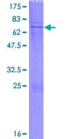 Human LIPT1 Protein (Recombinant GST)