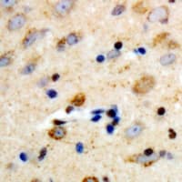 Polyclonal Rabbit anti-Human PLCB3 Antibody (C-Terminus, IHC, WB)