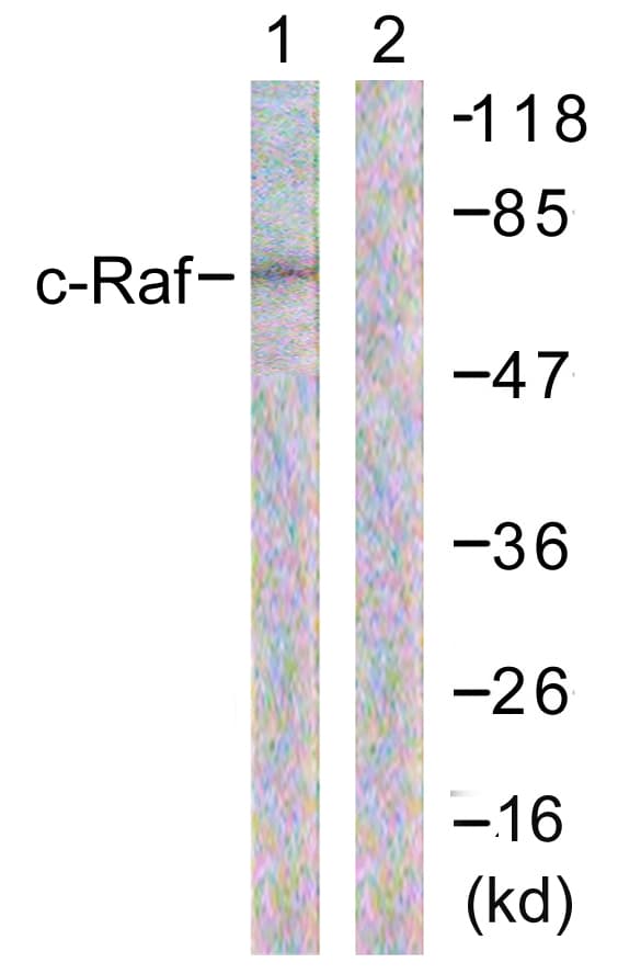 RAF1 / RAF Antibody (aa271-320)