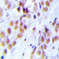 Polyclonal Rabbit anti-Human LSM4 Antibody (IHC, IF, WB)