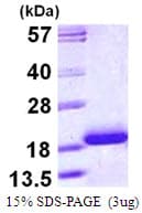 Human TNNC1 / Cardiac Troponin C Protein (Recombinant His)