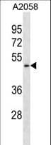 Polyclonal Rabbit anti-Human BAR / BFAR Antibody (aa1-30, WB)