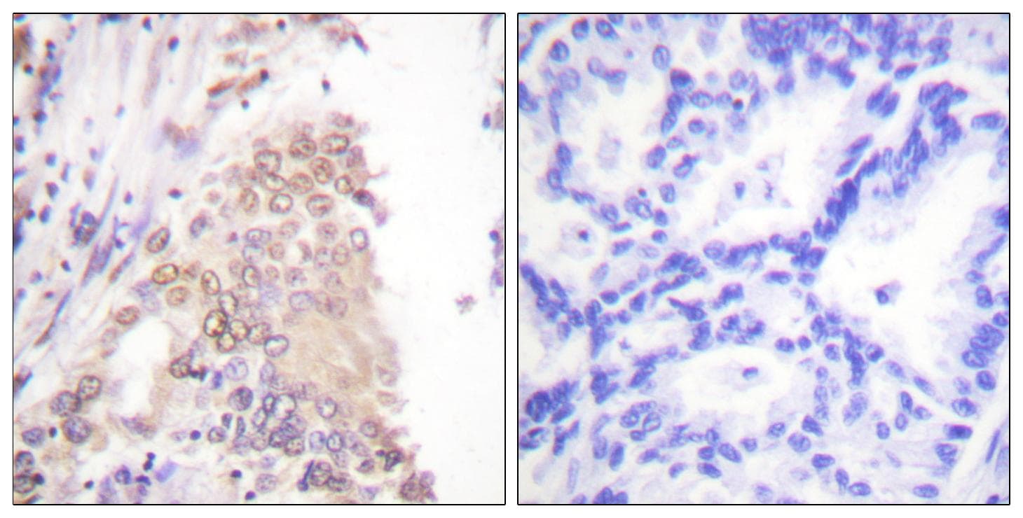 AML1 / RUNX1 Antibody (p276)