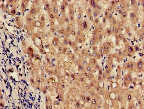 TPH2 Antibody