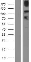 KDM4B / JMJD2B Protein (Over-Expression Lysate Myc-DDK (Flag))