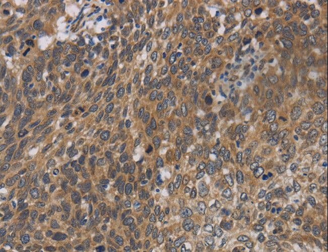 CYB5A / Cytochrome b5 Antibody