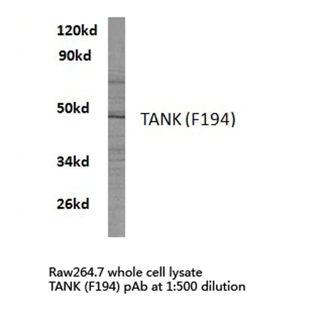 Polyclonal Rabbit anti-Human TANK Antibody (Phe194, IHC, IF, WB)