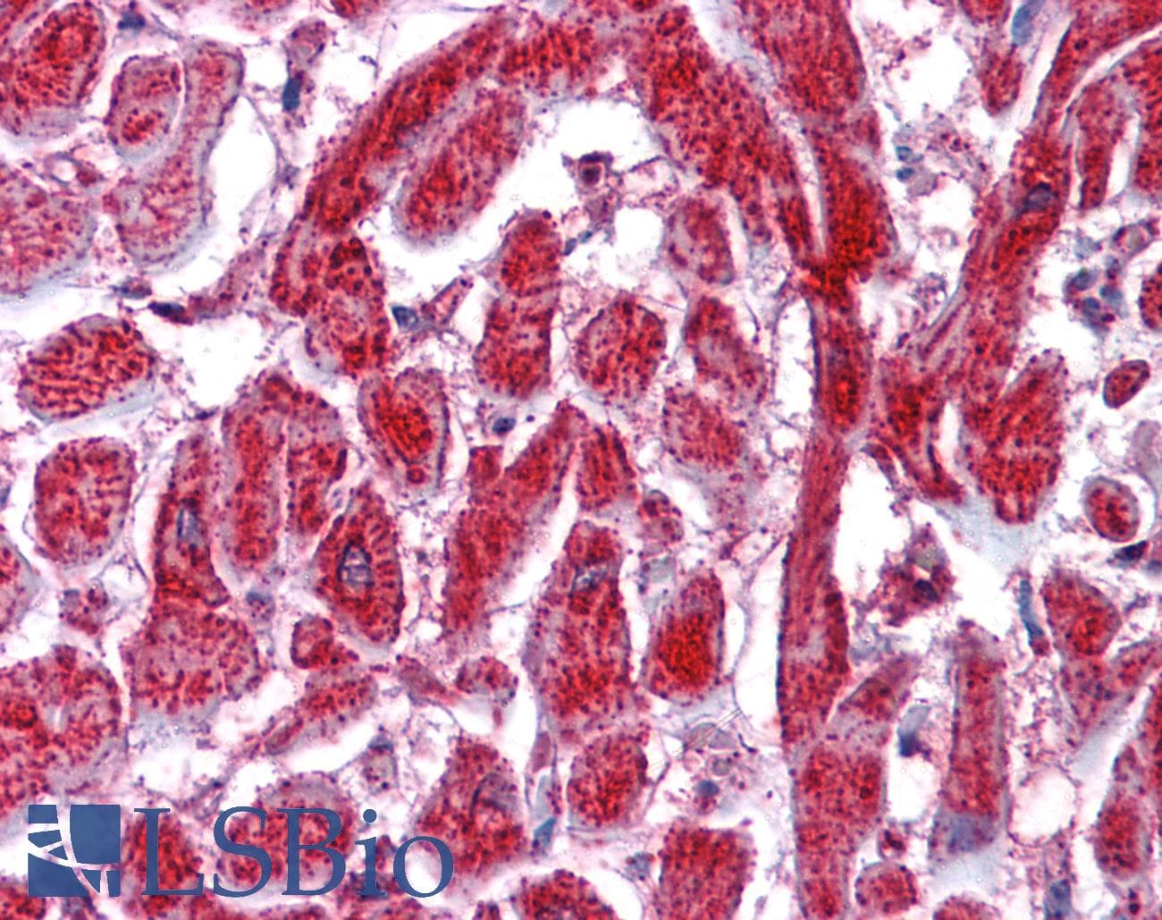 IHC-plus™ PDIA2 Antibody (aa337-348)