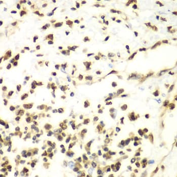 Polyclonal Rabbit anti-Human HDAC2 Antibody (IHC, IF, WB)
