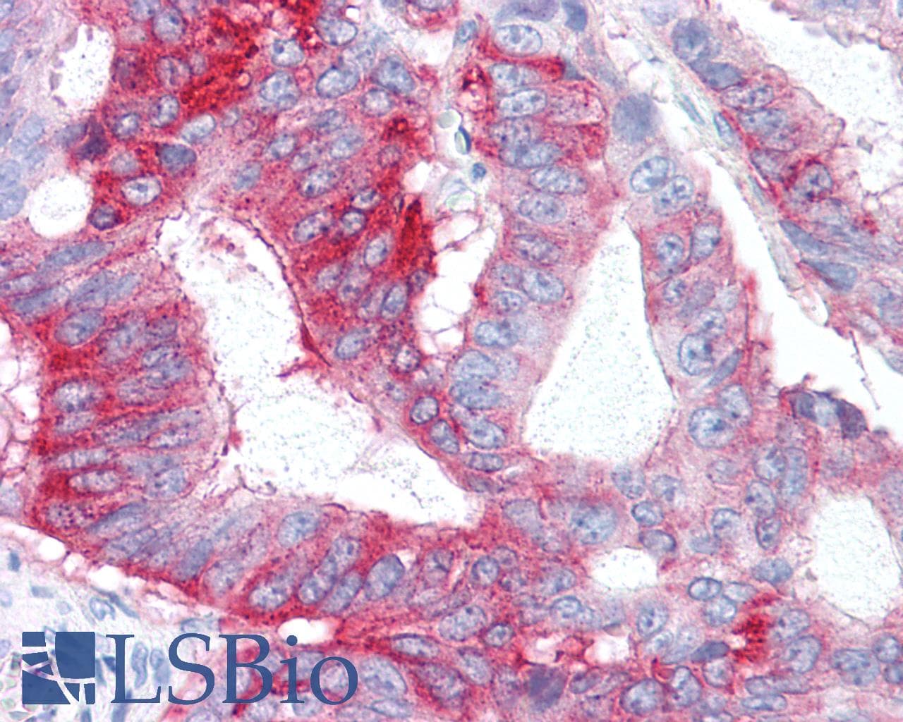 PathPlus™ GPR31 Antibody (Extracellular Domain)