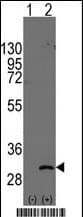 ASCL1 / MASH1 Antibody (Asp220, C-Terminal)