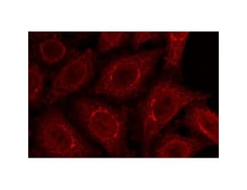 IHC-plus™ NUP210 / gp210 Antibody (C-Terminus)