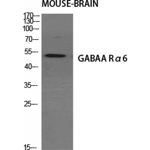 GABRA6 Antibody (30-110 aa, Internal)