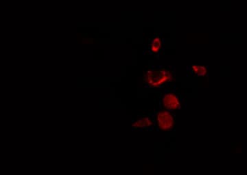 RBM34 Antibody