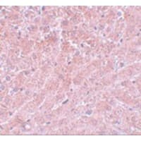 Polyclonal Rabbit anti-Human ATG101 Antibody (IHC, IF, WB)