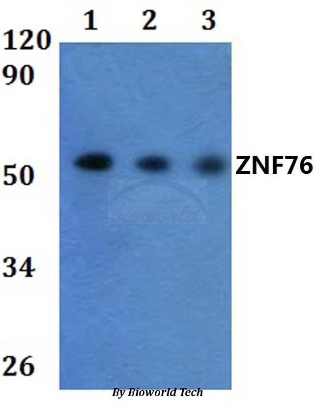 Polyclonal Rabbit anti-Human ZNF76 Antibody (WB)