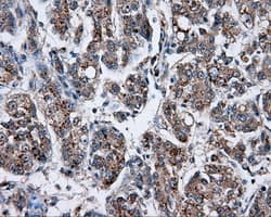 Monoclonal Mouse anti-Human NPR3 Antibody (clone OTI11H6, IHC, IF, WB)