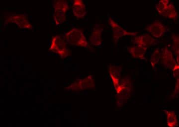 Polyclonal Rabbit anti-Human COX4I2 Antibody (IF, WB)
