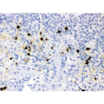 LCN2 / Lipocalin 2 / NGAL Antibody (aa21-200)