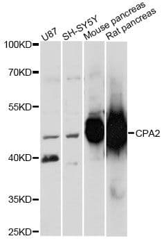 Polyclonal Rabbit anti-Human CPA2 Antibody (WB)