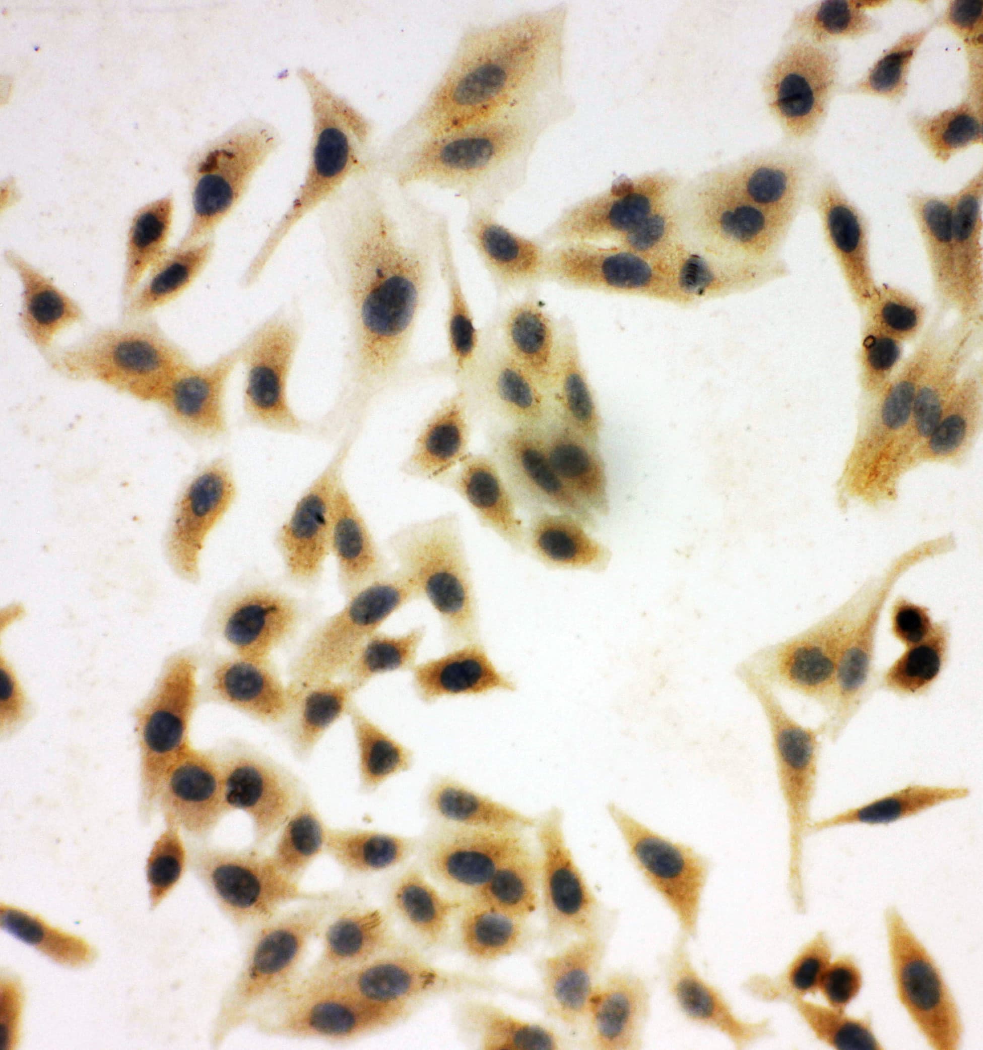 NRG1 / Heregulin / Neuregulin Antibody (aa617-636)