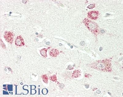 IHC-plus™ GRIA1 / GLUR1 Antibody (790-870 aa)