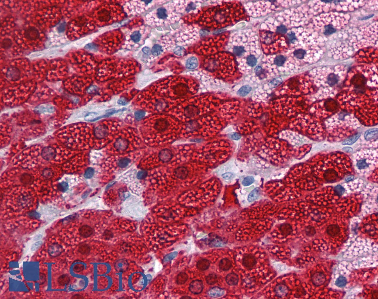 IHC-plus™ Monoclonal Mouse anti-Human GSTA3 Antibody (clone 1F11, IHC, WB)