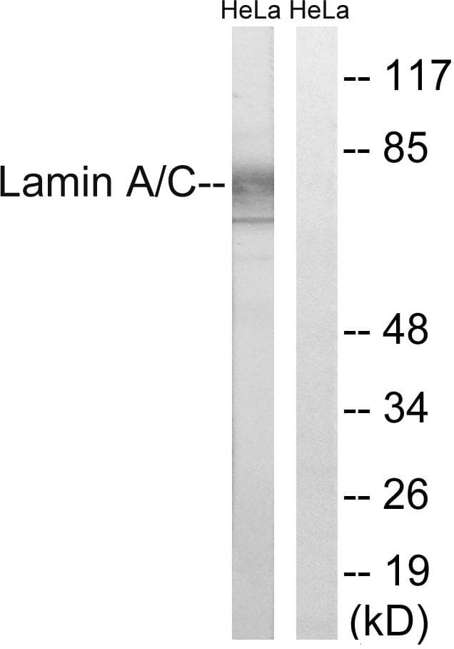 Polyclonal Rabbit anti-Human LMNA / Lamin A+C Antibody (p22, WB)