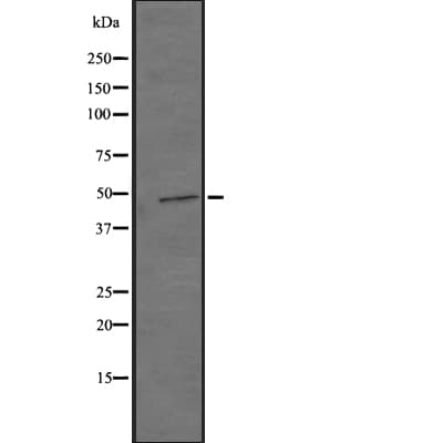 GPR22 Antibody